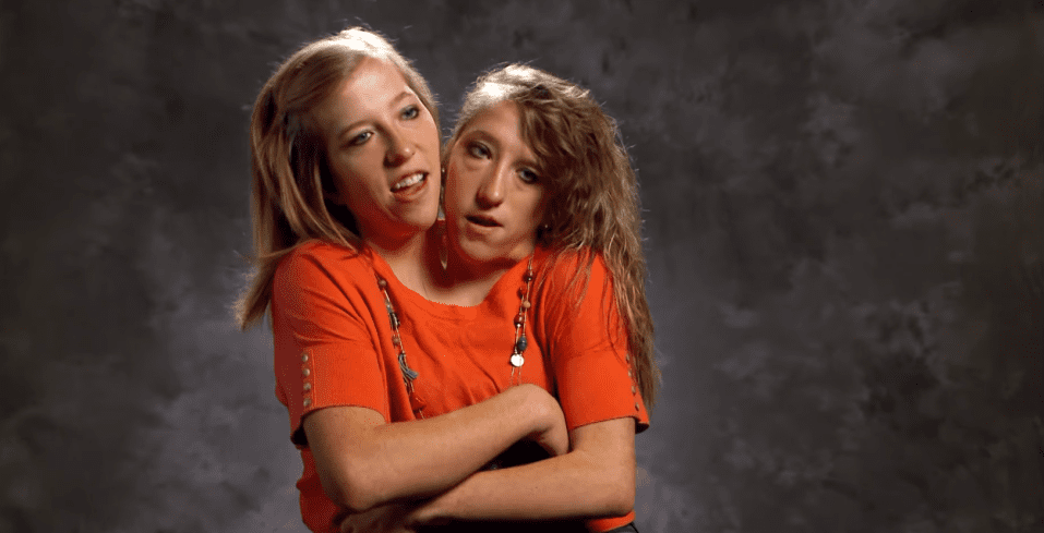 abby and brittany hensel 2019 separated