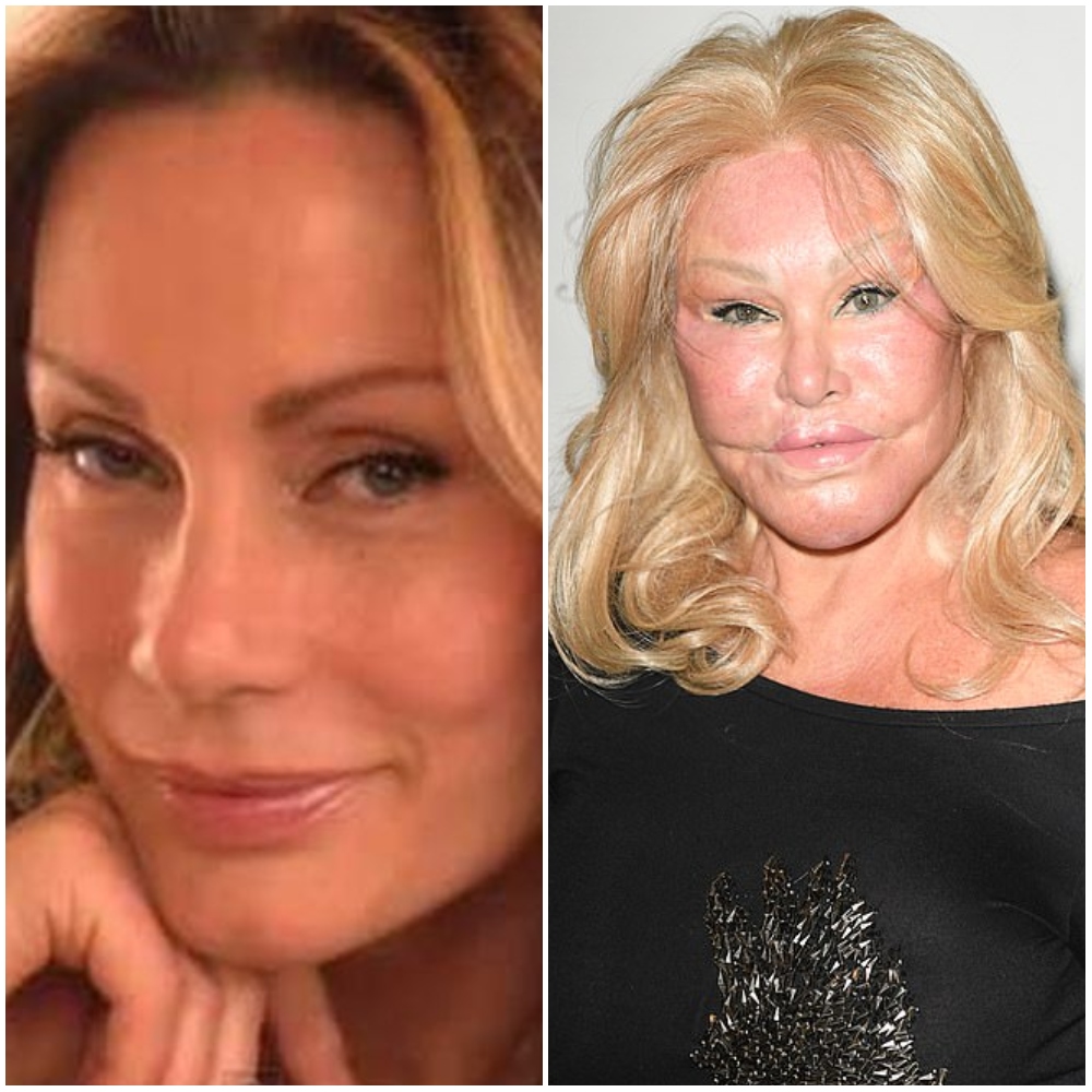 List 93+ Pictures Jocelyn Wildenstein Before And After Pictures Updated